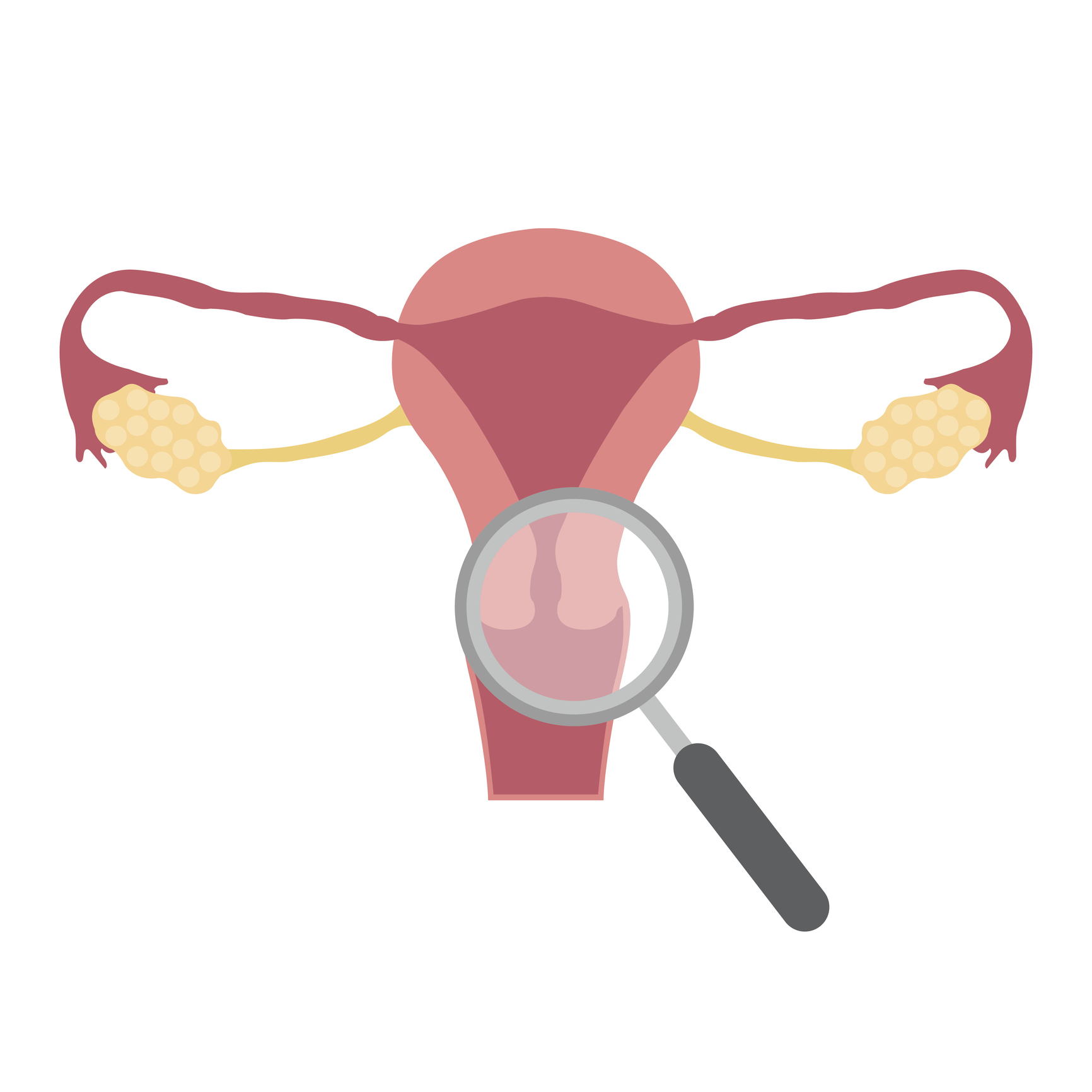 Diagram of a cervix