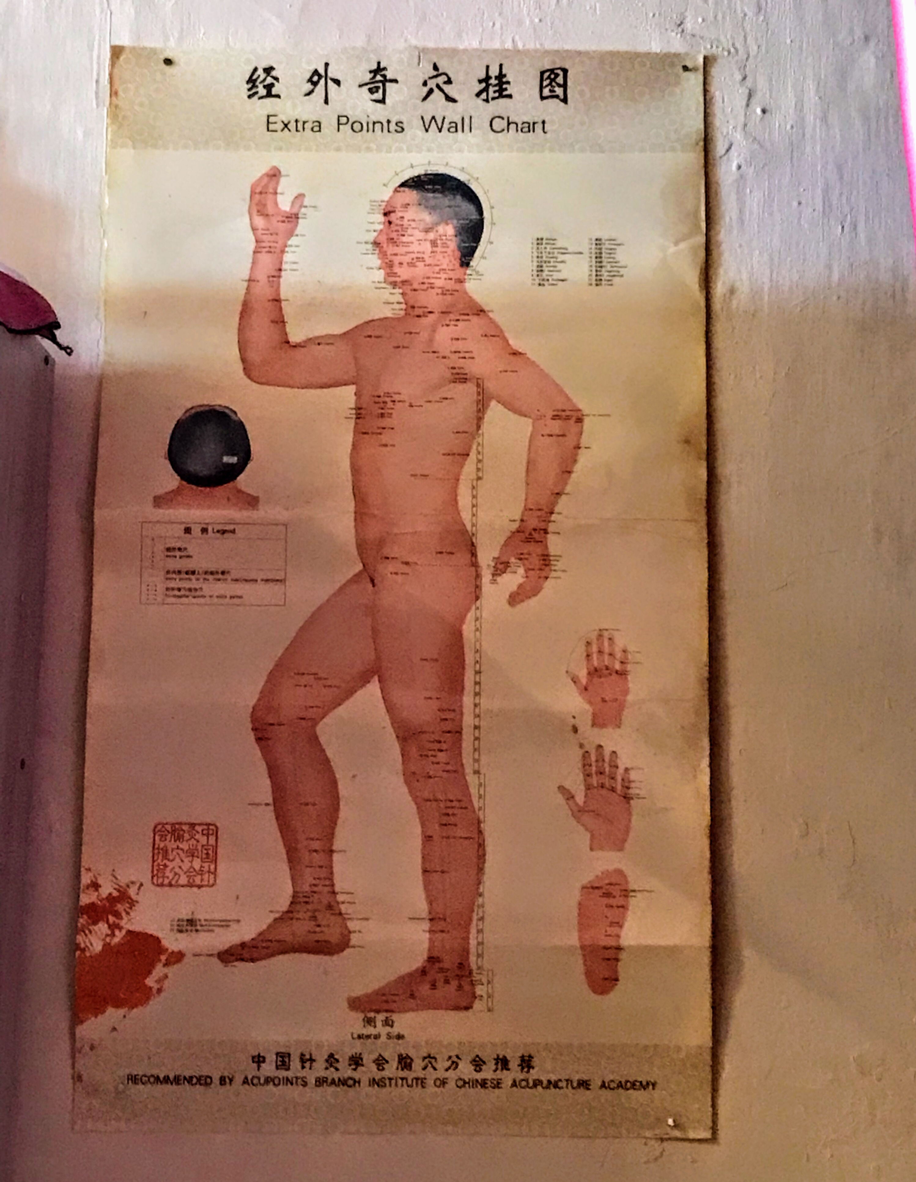 Poster in cupping salon, Melaka, Malaysia