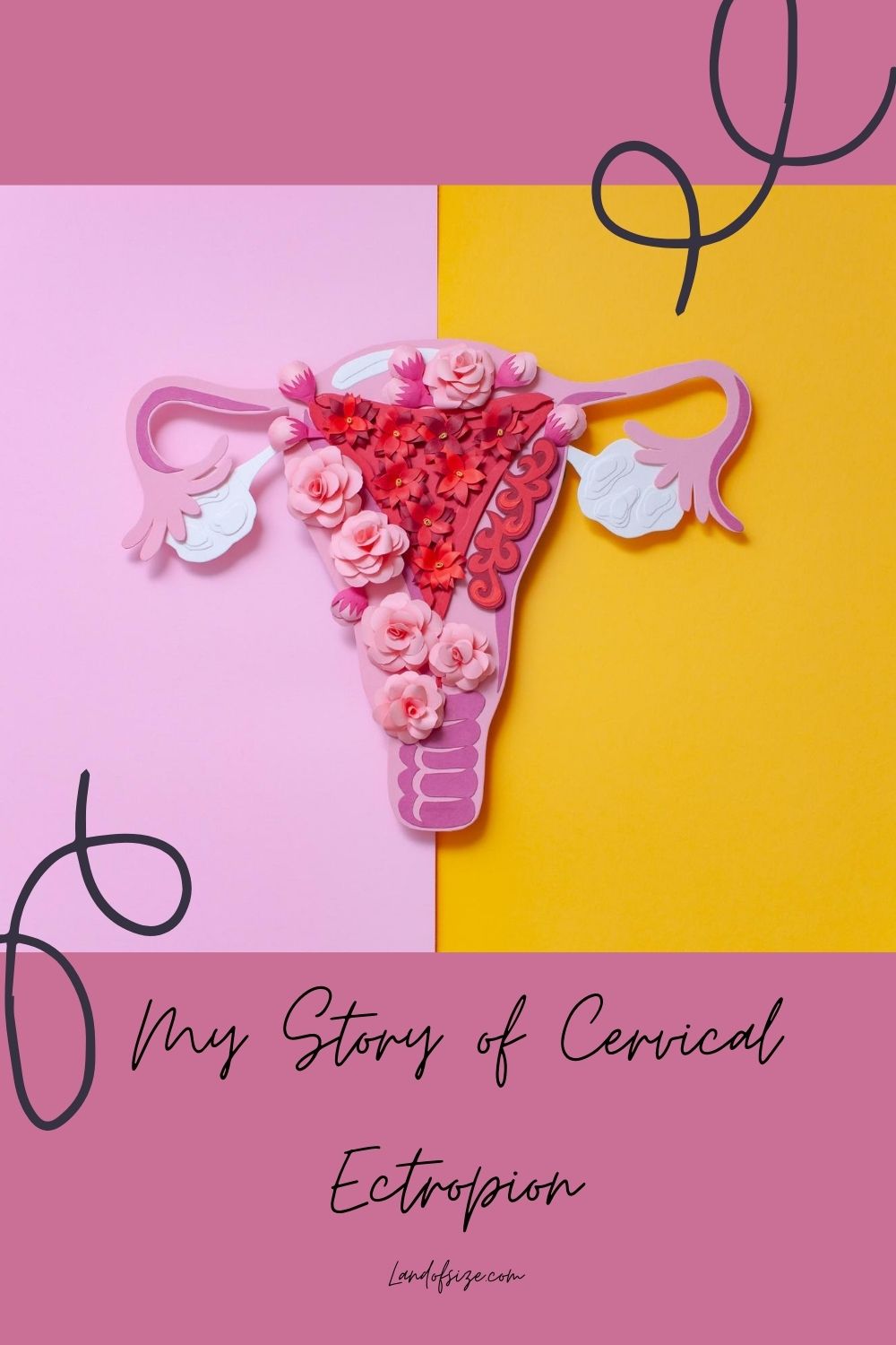 My story of cervical ectropion - Land of Size